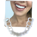 Perfect smile dental coverage - comfortable veneers