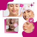 Even Skin Tranexamic Cream